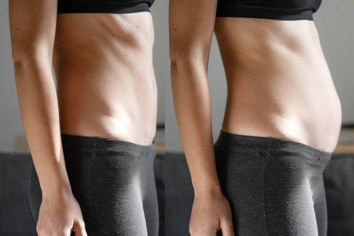 How long does diastasis recti take to improve Greater London (Merton)?