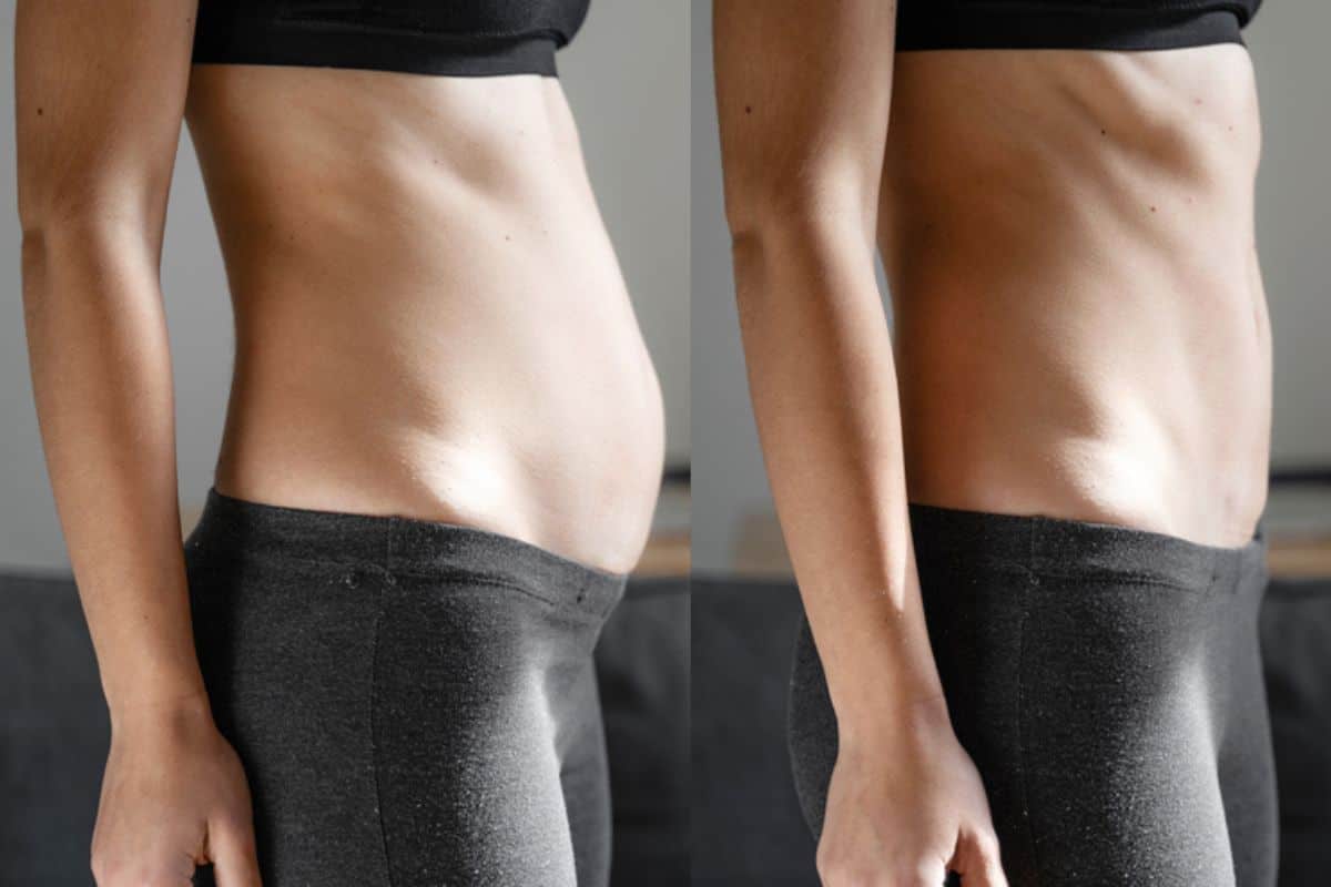 Post-Pregnancy: What Happens to Your Abdominal Muscles After Birth Greater London (Merton)