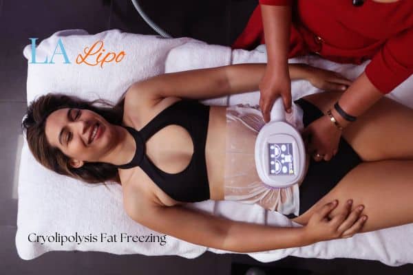 woman getting cryolipolysis Greater London (Merton)