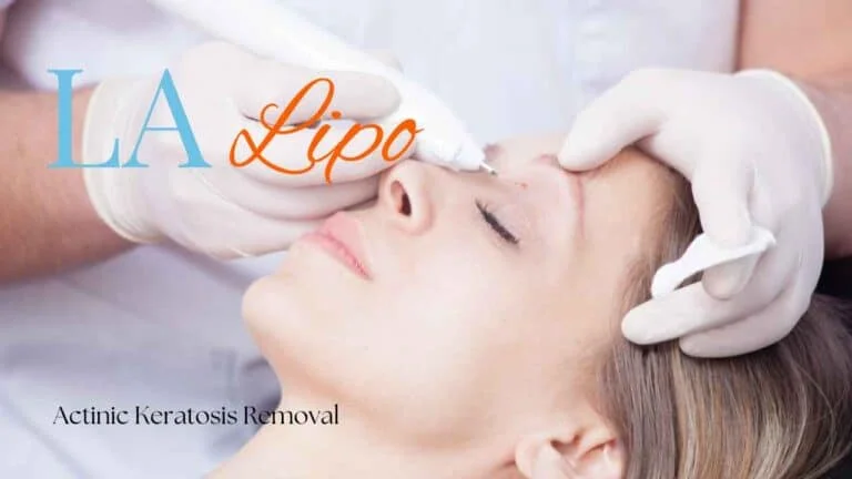 Woman receiving Actinic Keratosis Removal Treatment Greater London (Merton)