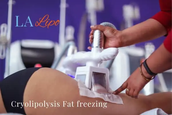 women getting fat freezing Greater London (Merton)