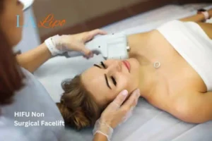 Woman having Hi-Fu to reduce wrinkles Greater London (Merton).