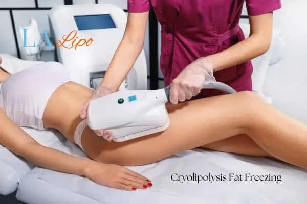 Woman receiving coolsculpting Greater London (Merton) treatment on her thighs