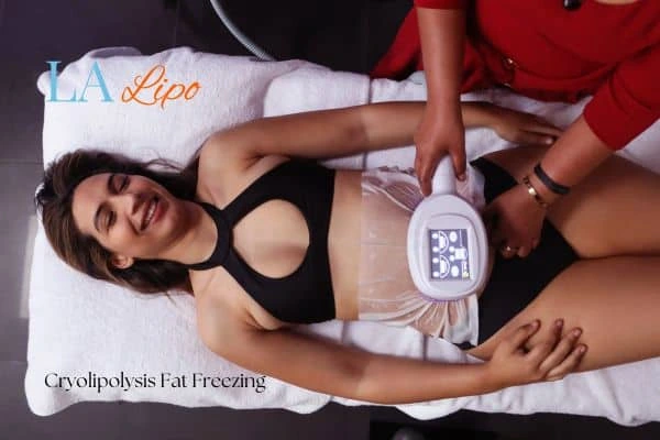 woman getting cryolipolysis Greater London (Merton)