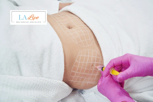 aqualyx fat dissolving injections Greater London (Merton)