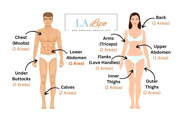 LA LIPO Cryolipolysis Areas Greater London (Merton)