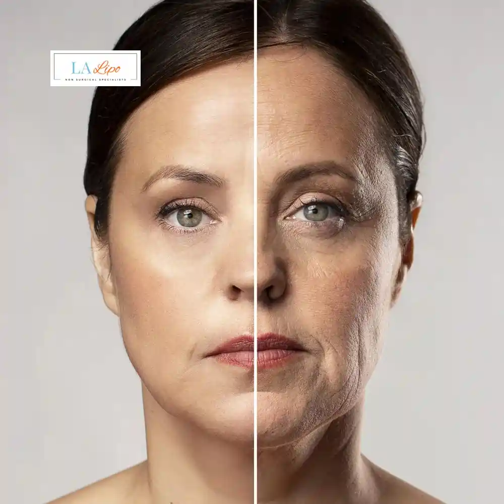 How Can You Tell If Non-Surgical Skin Tightening Is Right for You Greater London (Merton)?