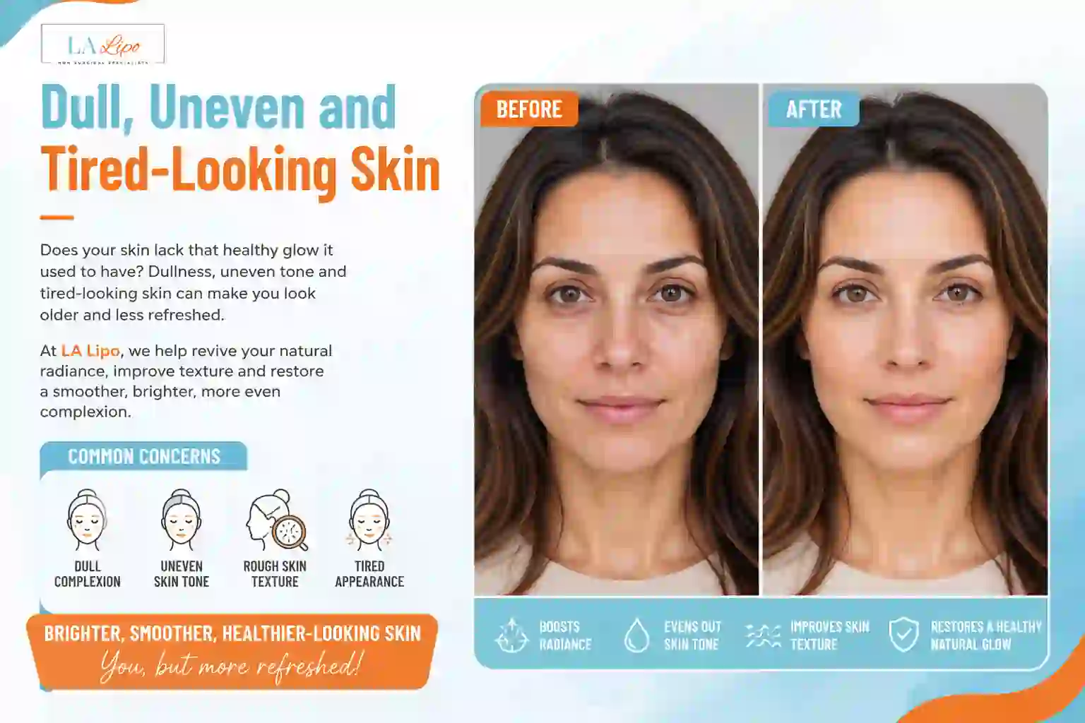 Sign #5: Dull, Uneven and Tired-Looking Skin Greater London (Merton)