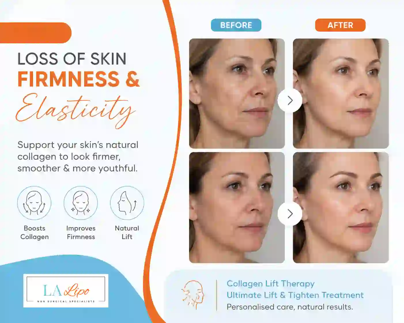 Sign #7: Loss of Skin Firmness and Elasticity Greater London (Merton)