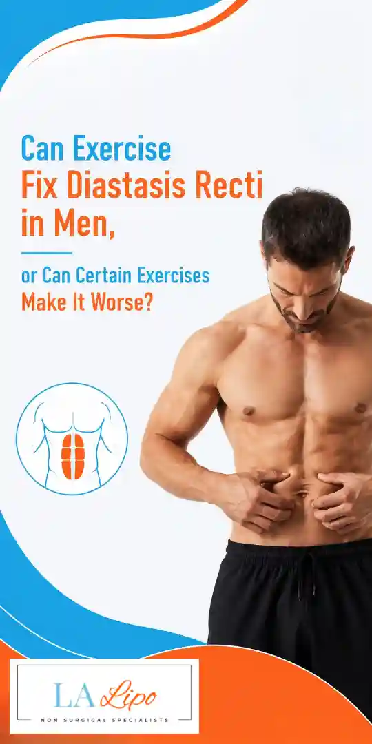 Can Exercise Fix Diastasis Recti in Men, or Can Certain Exercises Make It Worse Greater London (Merton)?